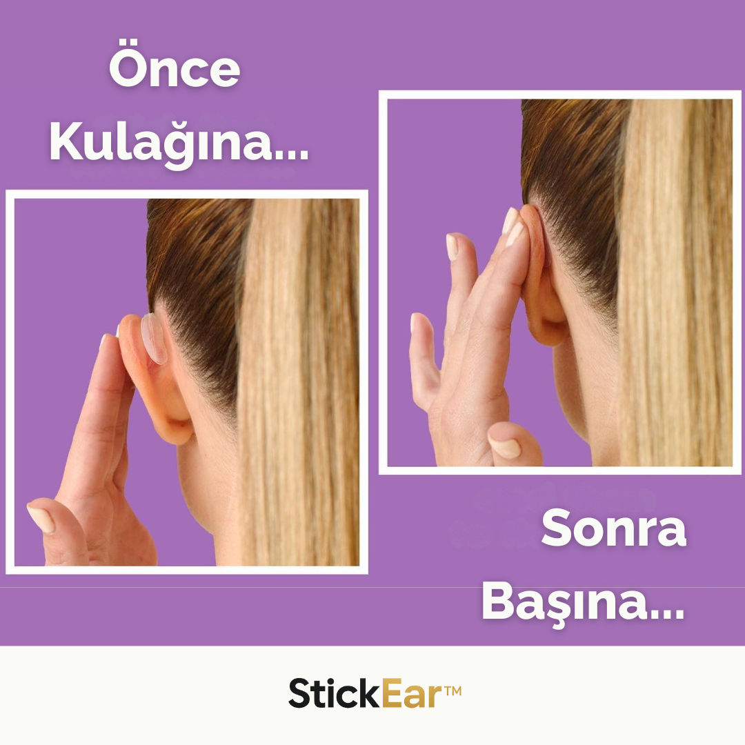 StickEar™ Kulak Düzeltme Bandı