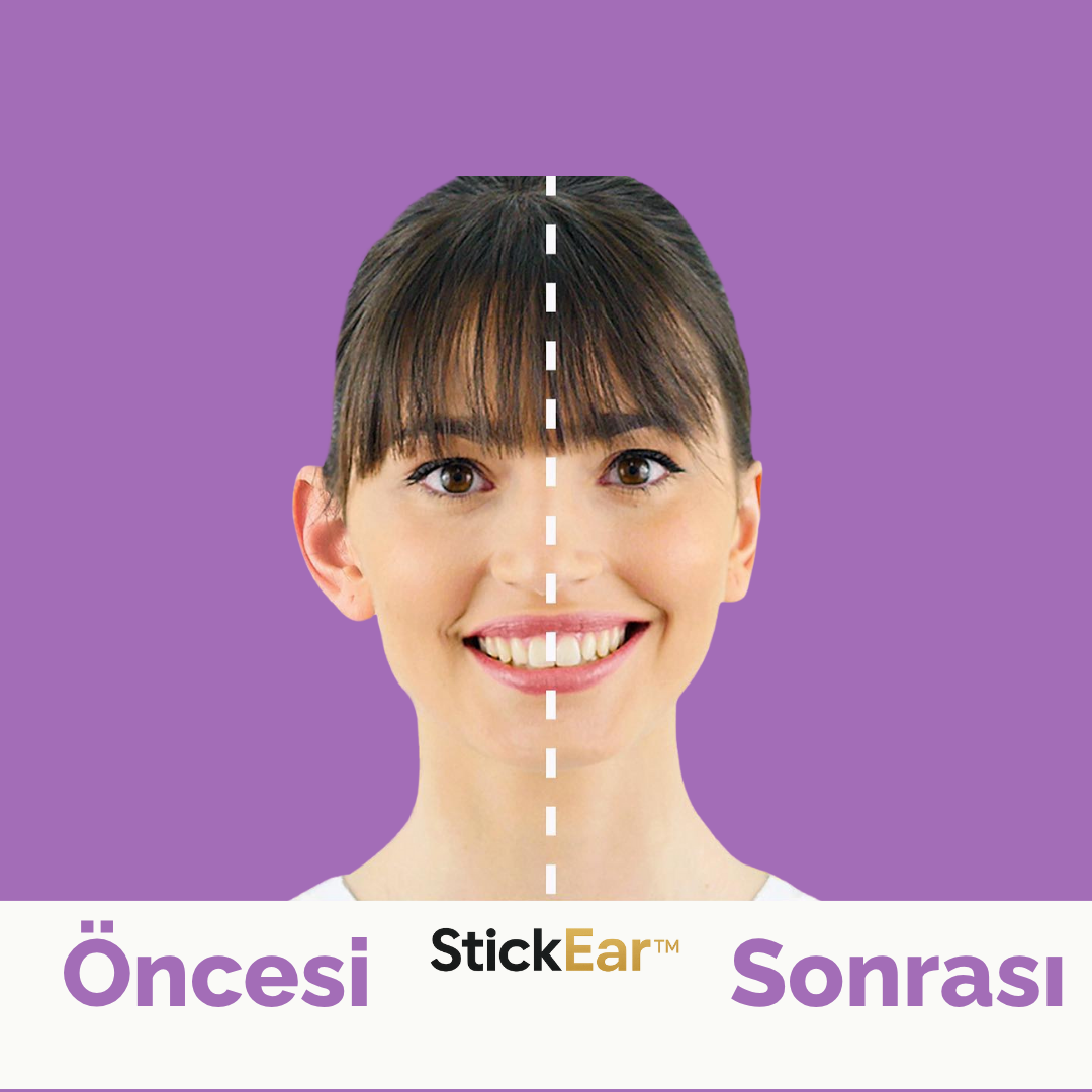 StickEar™ Kulak Düzeltme Bandı