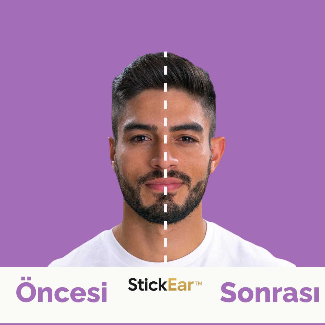 StickEar™ Kulak Düzeltme Bandı