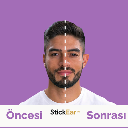 StickEar™ Kulak Düzeltme Bandı